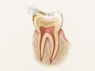 A cross-section of a tooth showing brownish surface stains on the enamel being gently polished away, while a deeper gray-yellow discoloration remains inside the dentin, illustrating that whitening toothpaste only affects extrinsic stains.